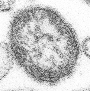 894px-measles_virus